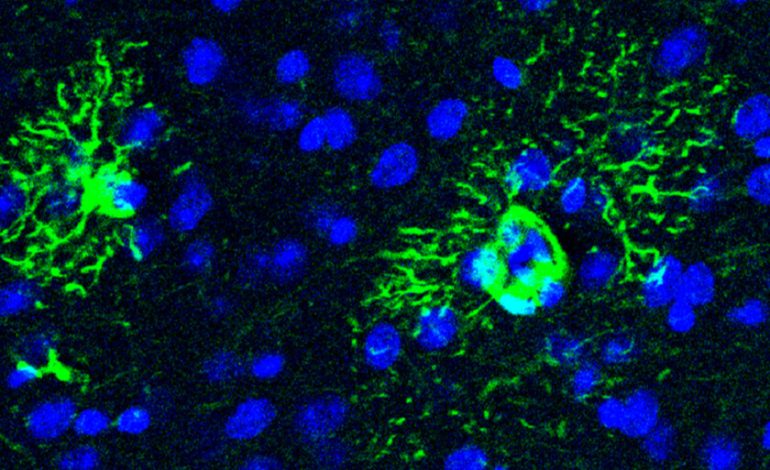 El Alzheimer se inicia mucho antes de la aparición de sus síntomas, y hemos identificado uno de sus primeros mecanismos.