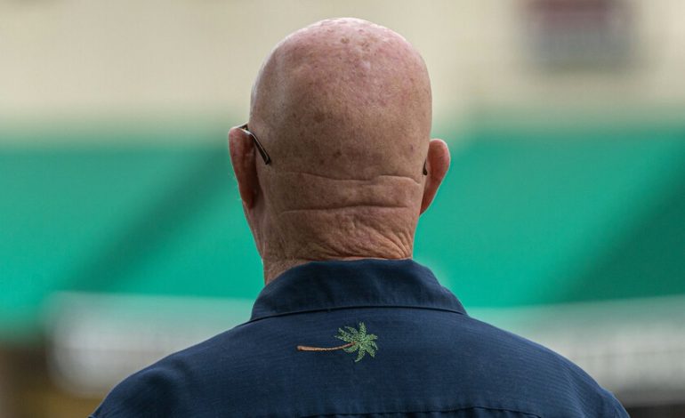 Minoxidil parecía el gran medicamento milagroso contra la calvicie. Una compañía farmacéutica financiada por Google acaba de superarlo
– La nación