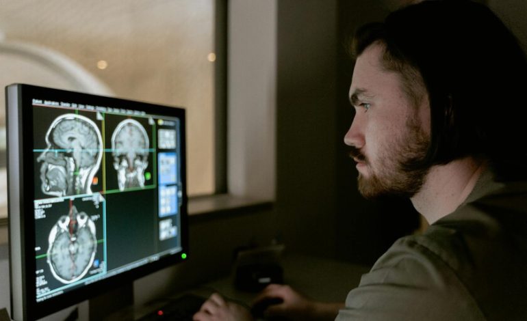 Lo que sabemos sobre los riesgos del sufrimiento de un accidente cerebrovascular joven
– La nación