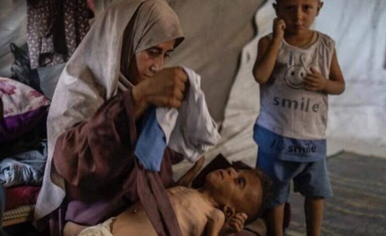 “Photimbolol” de hambre en Gaza es falso, condena la investigación
– La nación