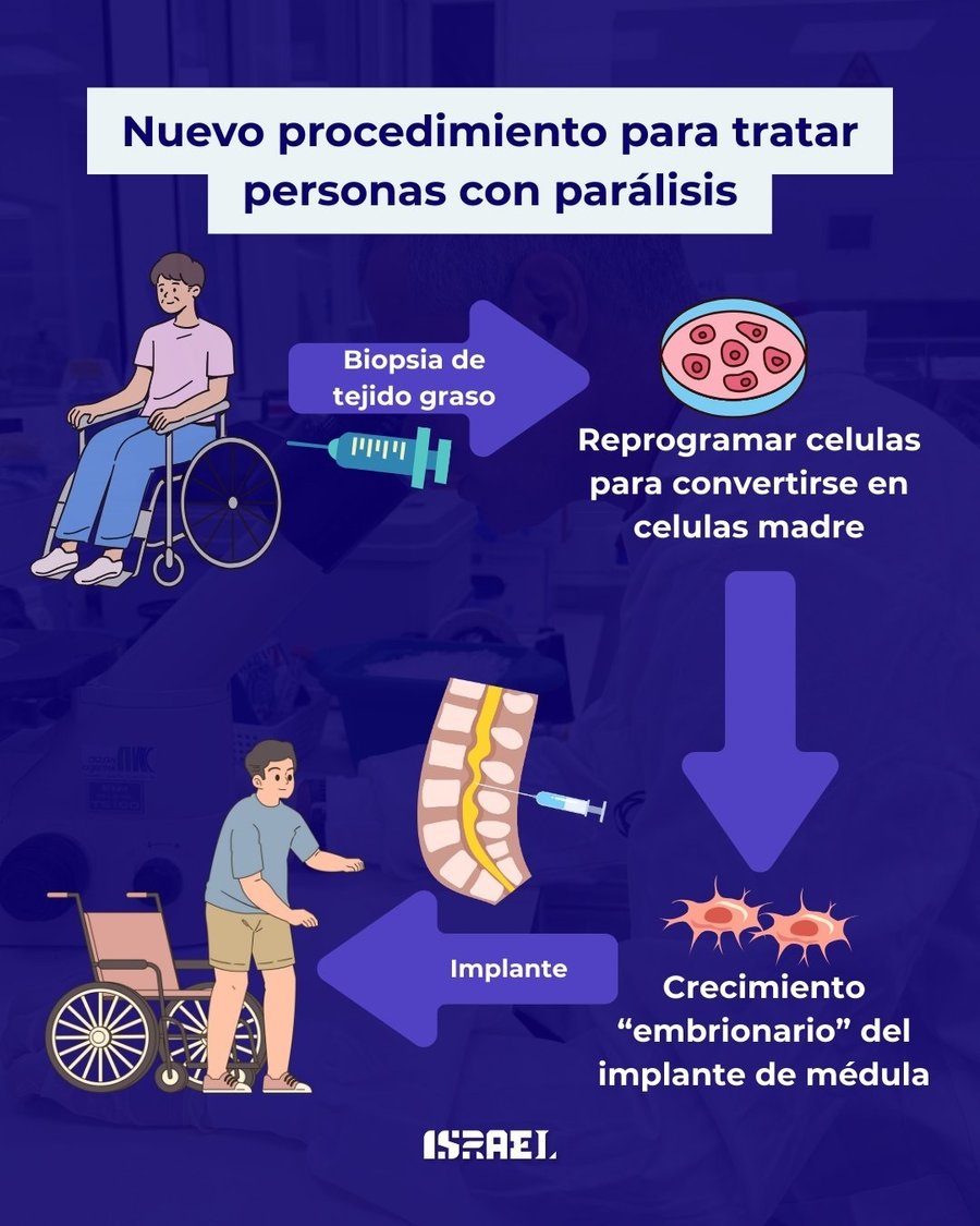 El procedimiento innovador creado en Israel devolverá la movilidad a las personas paralizadas

 – La nación