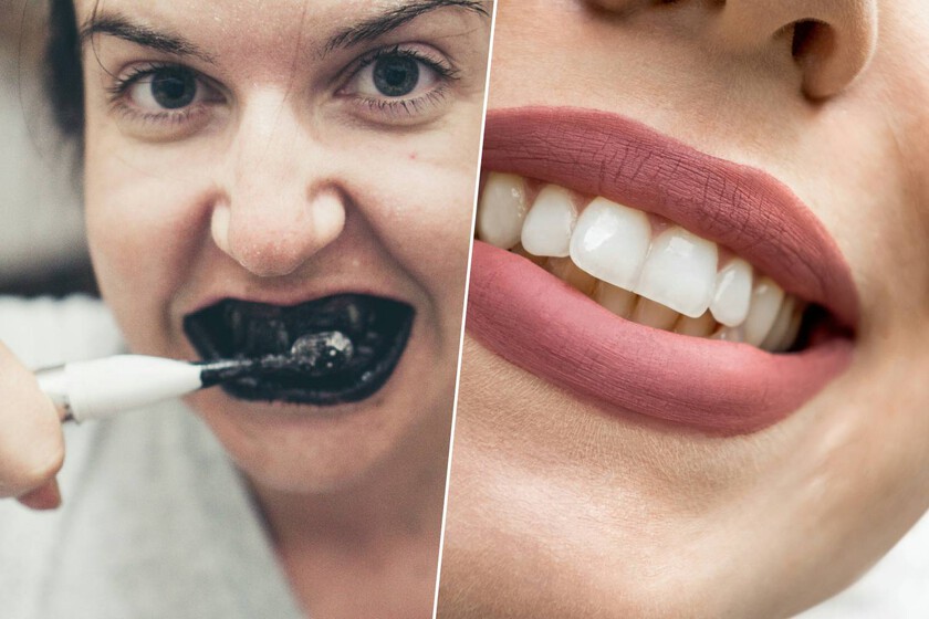 La peligrosa moda de Tikok que puede destruir su sonrisa

 – La nación