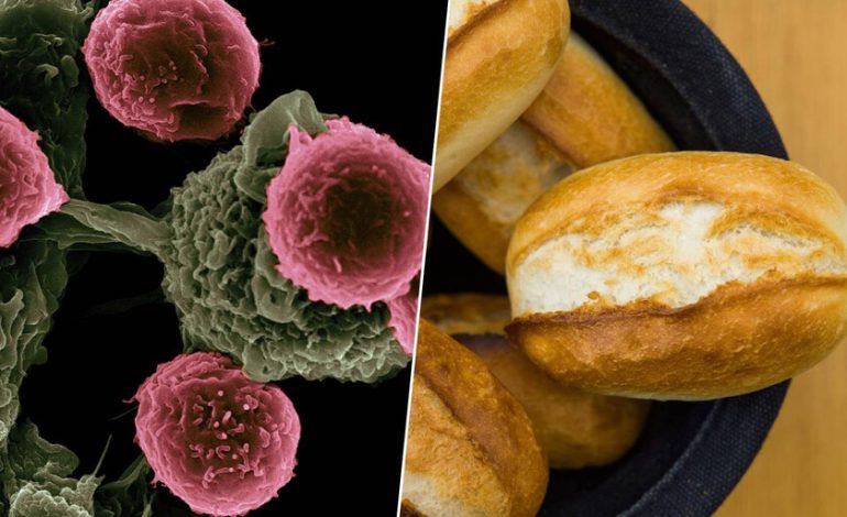 Un estudio acaba de vincularlos con un mayor riesgo de cáncer
– La nación