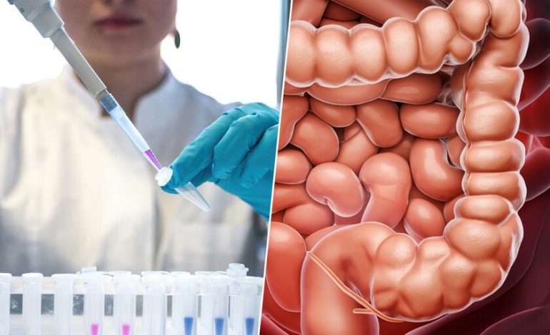 El número de casos de cáncer de colon entre los jóvenes está aumentando de forma preocupante. Tenemos una sospecha: falta de ejercicio
 – La nación