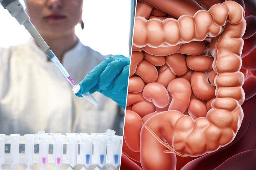 El número de casos de cáncer de colon entre los jóvenes está aumentando de forma preocupante. Tenemos una sospecha: falta de ejercicio
 – La nación